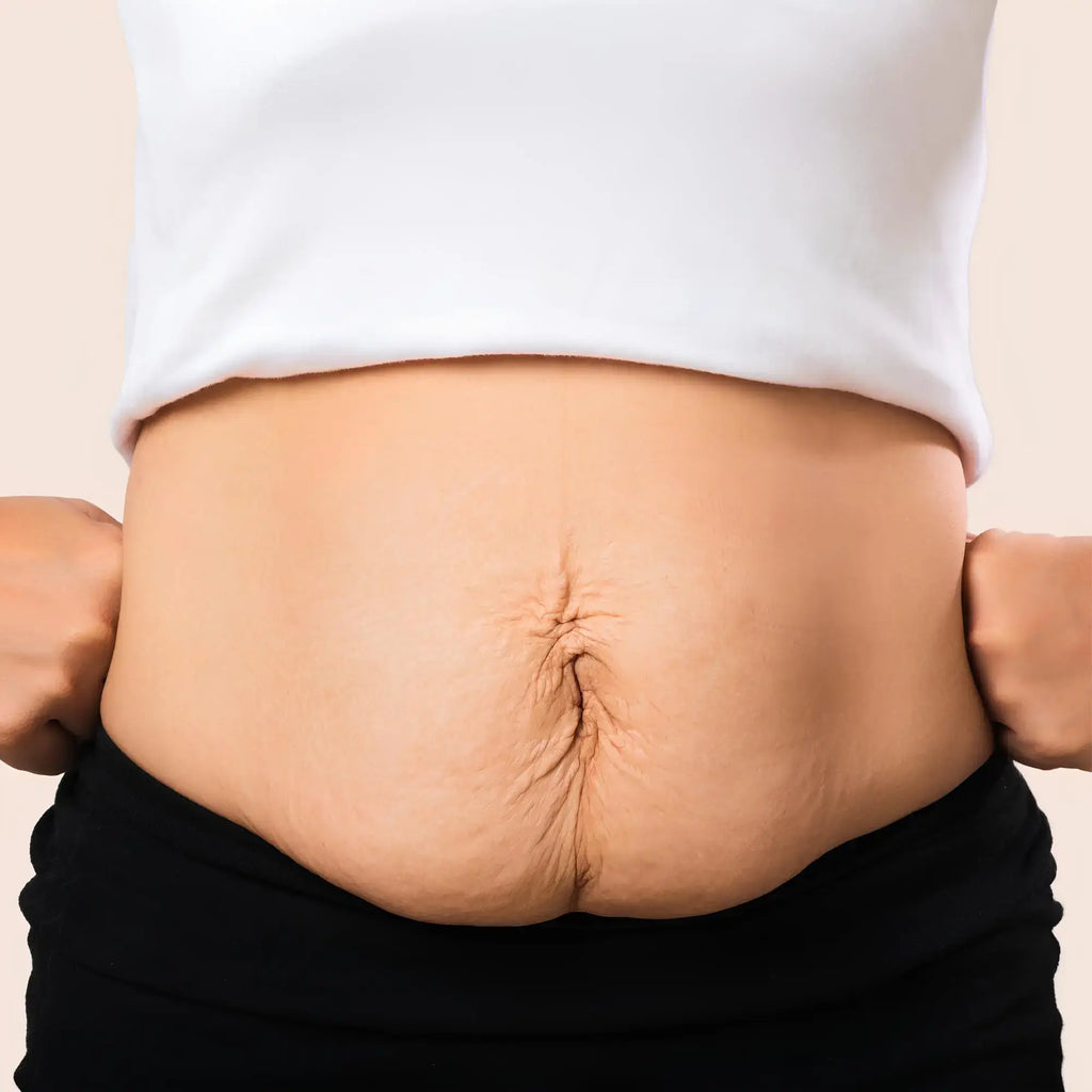 Bermuda Modeladora Pós-Parto Diamond – Modela, Sustenta e Alivia Inchaço